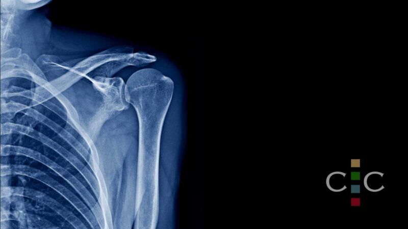 fracture pictures cost illinois