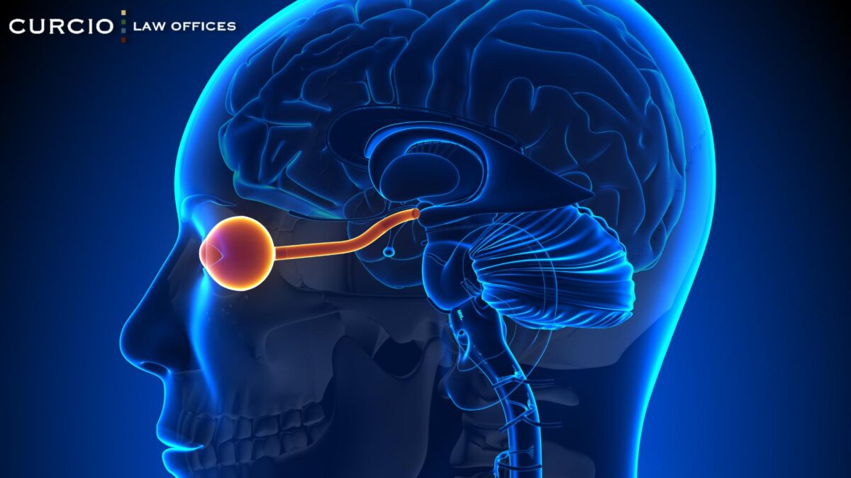 difference between neuropathy and radiculopathy