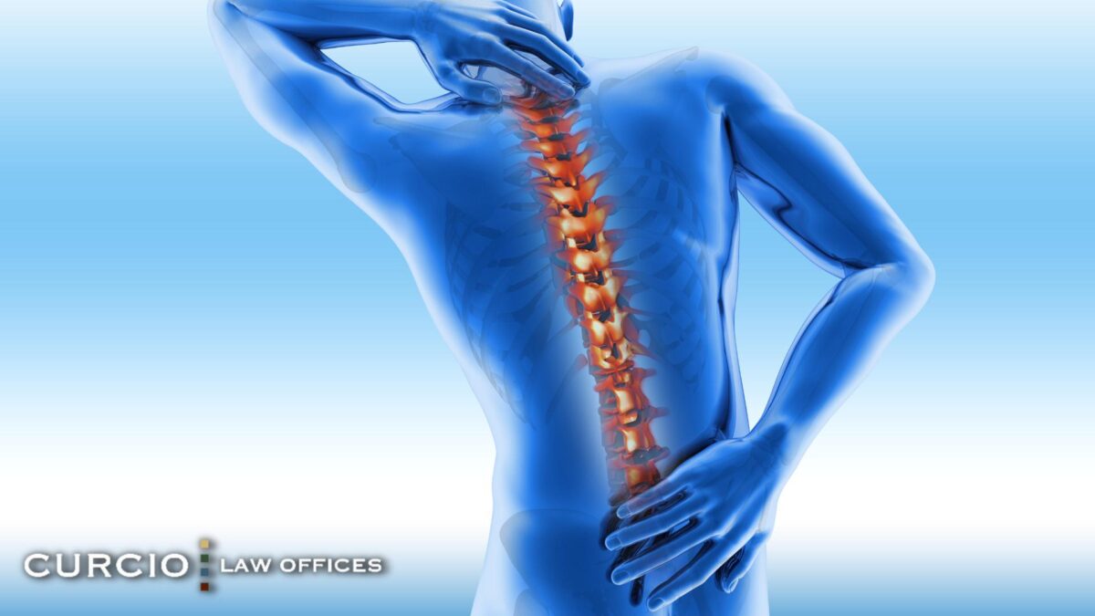 neuropathy vs radiculopathy