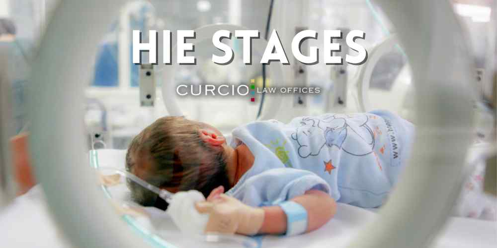 hie stages